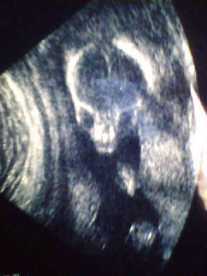 babyfred20weeks.jpg